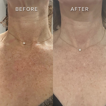 REVERSES SIGNS OF SUN DAMAGE